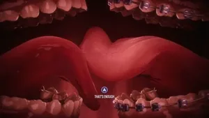 游核