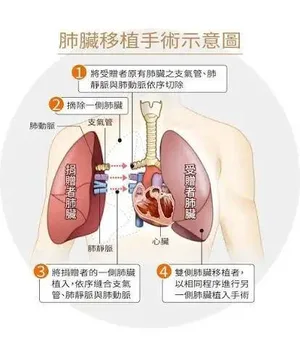游核